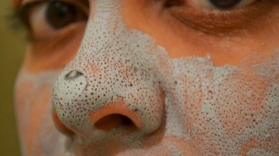 How-to-get-rid-of-blackheads-on-nose-fast-and-natural-home-remedies